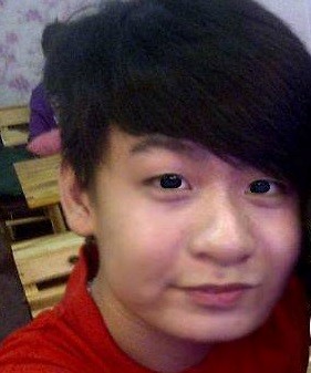Teen boy Việt 17 tuổi công khai hình ảnh phẫu thuật thẩm mỹ 3