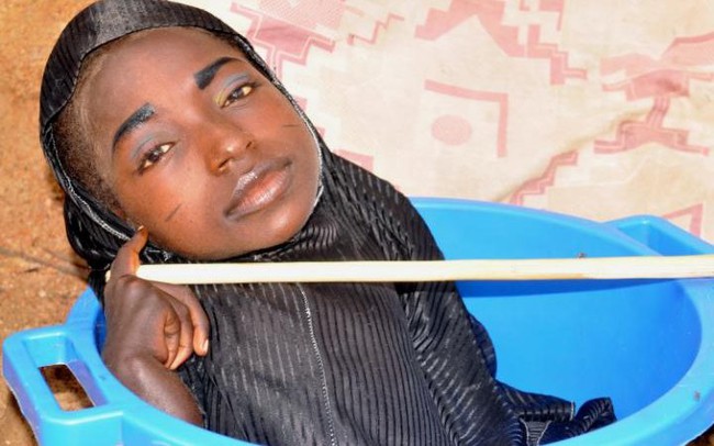 C&acirc;u chuyện cuộc đời của c&ocirc; g&aacute;i 19 tuổi chỉ lớn mỗi c&aacute;i đầu khiến h&agrave;ng triệu người x&oacute;t xa - Ảnh 1.