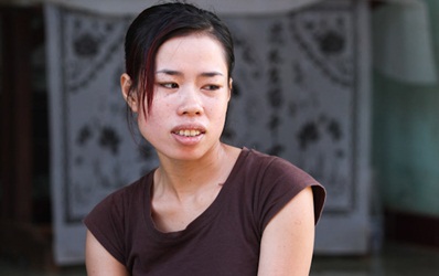 cấp cứu