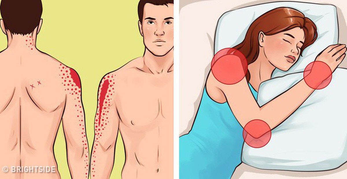 Nhiều người thường có thói quen nằm nghiêng nhưng lại không ...