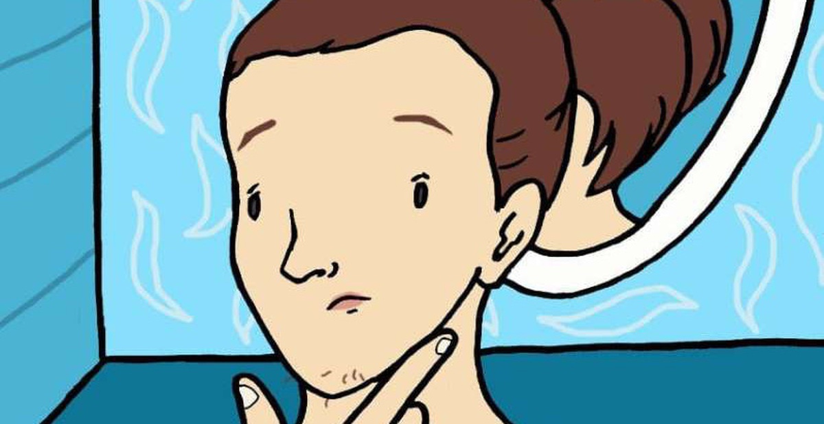 7 nguyên nhân ít ai biết về sự xuất hiện của lông, râu dưới cằm ở nữ giới