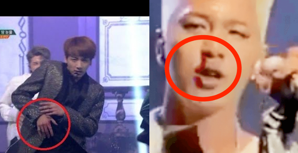 Idol Kpop cắn răng chịu đau để biểu diễn khi dính chấn thương, chảy máu ...