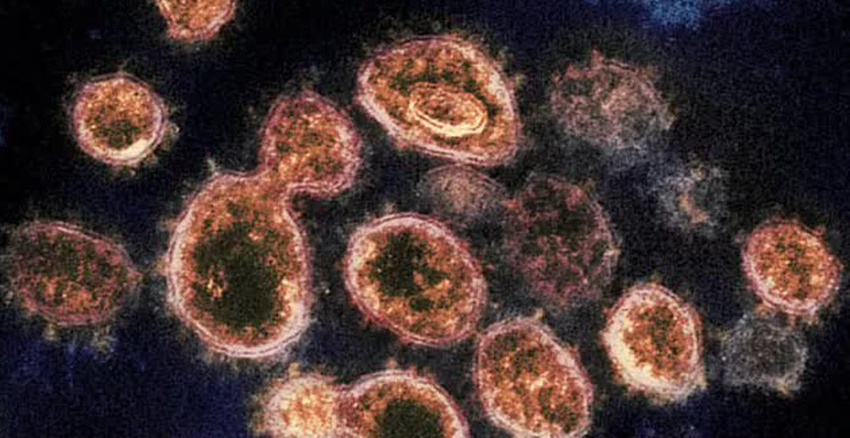 Phát hiện điểm yếu của virus SARS-CoV-2