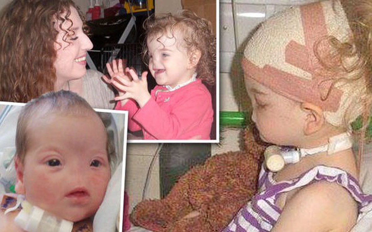 Từng gây xúc động cho cả thế giới, bé gái sinh ra không có ...