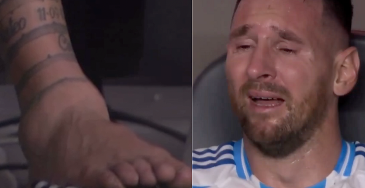 Cận cảnh cổ chân sưng vù của Messi khiến anh phải rời trận Chung kết ...