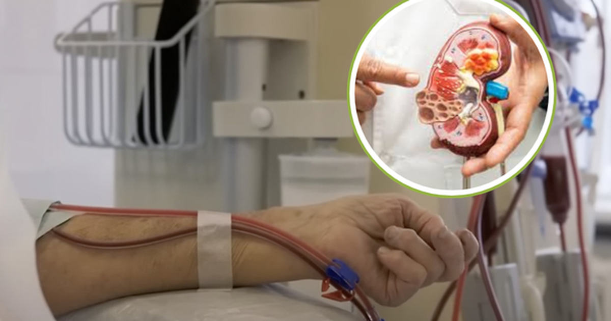 Người trẻ bị suy thận ngày càng cao: “Nằm lòng” 3 lời khuyên ...