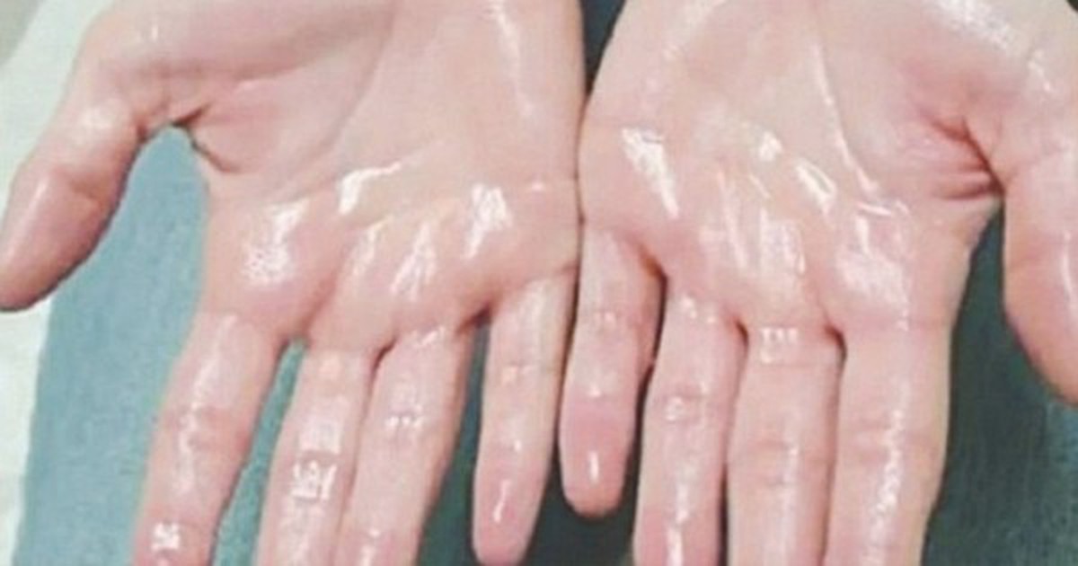 Cách kiểm soát tình trạng ra mồ hôi tay hiệu quả bậc nhất