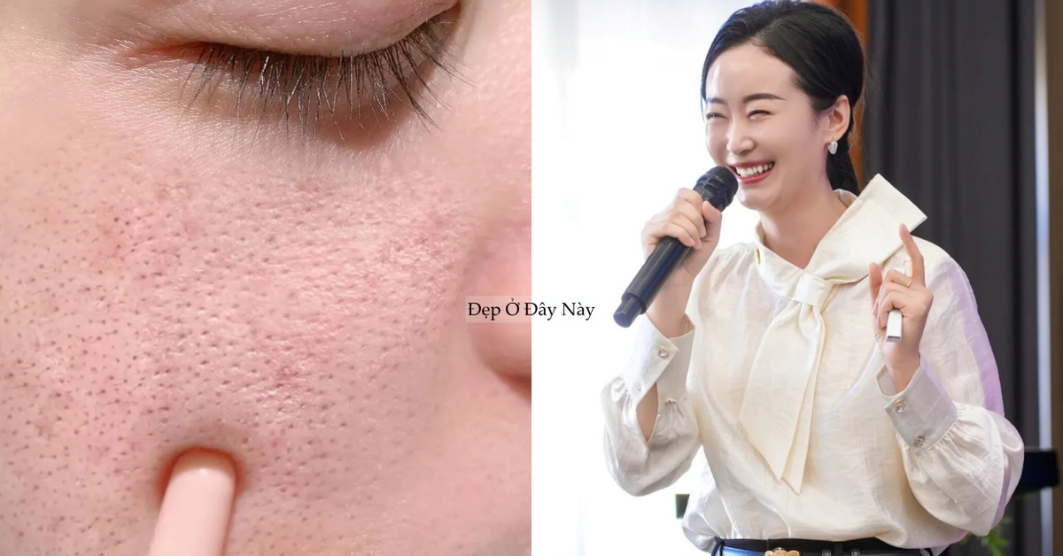 Chuyên gia chỉ ra: Có tới 4 loại lỗ chân lông to và cách khắc phục hiệu quả nhất