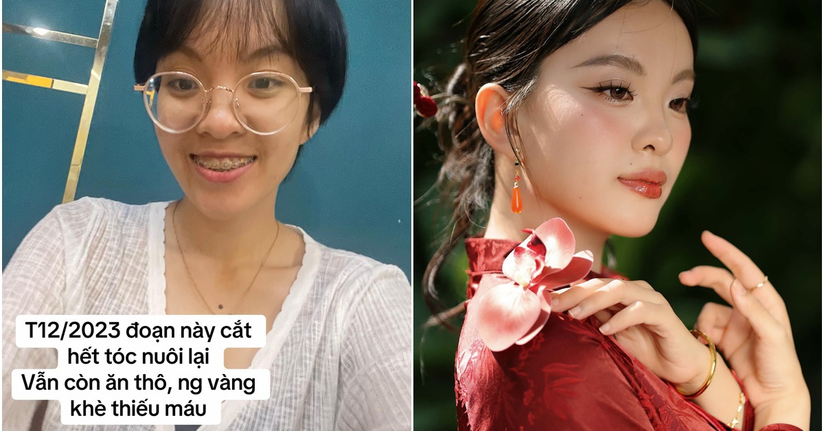 Gallery - Màn thay đổi "đáng đồng tiền" của cô gái TP.HCM sau khi từ bỏ ăn thô, niềng răng và mổ mắt cận