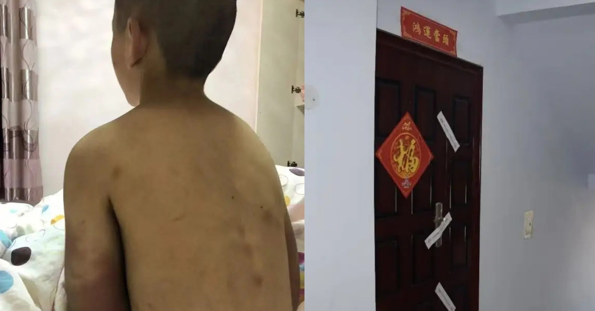 Bi kịch của cậu bé 14 tuổi vẫn phải mặc tã