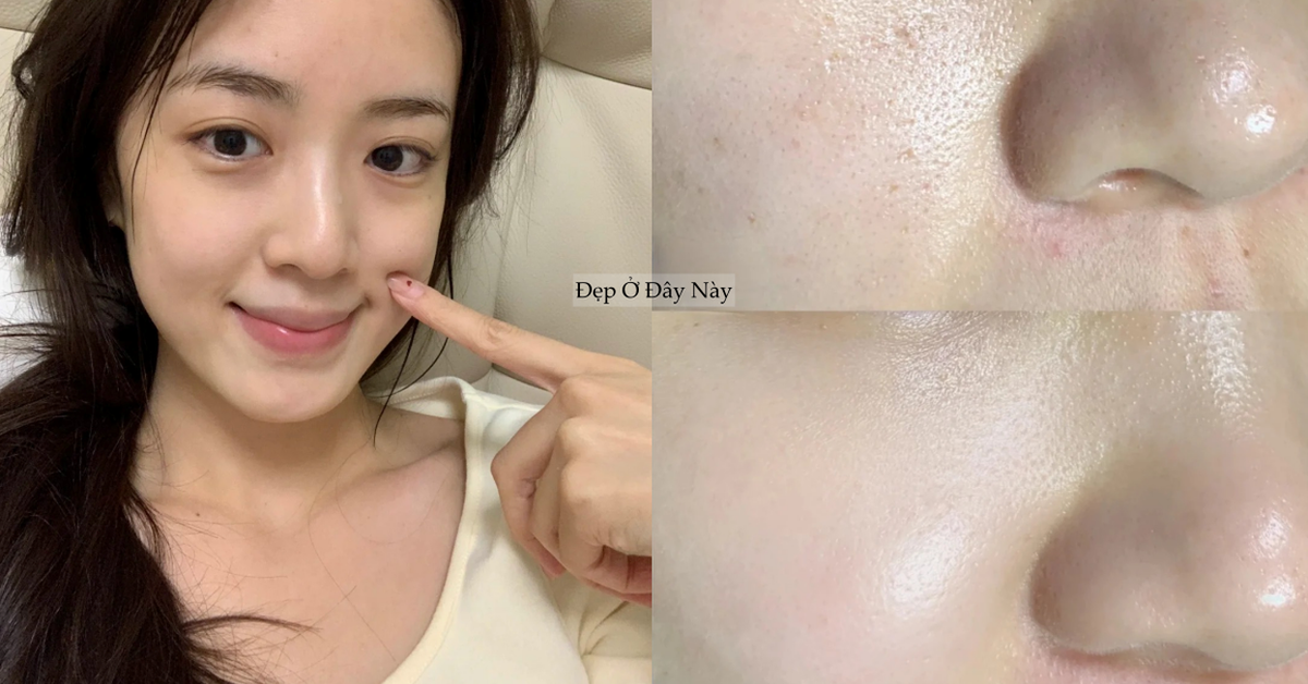 5 serum ngừa lão hóa "made in Vietnam" giúp ngừa lão hóa hiệu quả