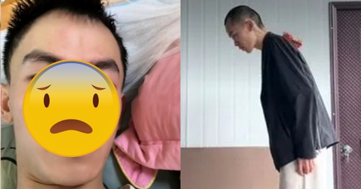 Nam diễn viên sinh năm 1999 bị đột quỵ nhồi máu não vì thức khuya, tình trạng liệt mặt và chỉ còn 30 kg hiện tại gây xót xa