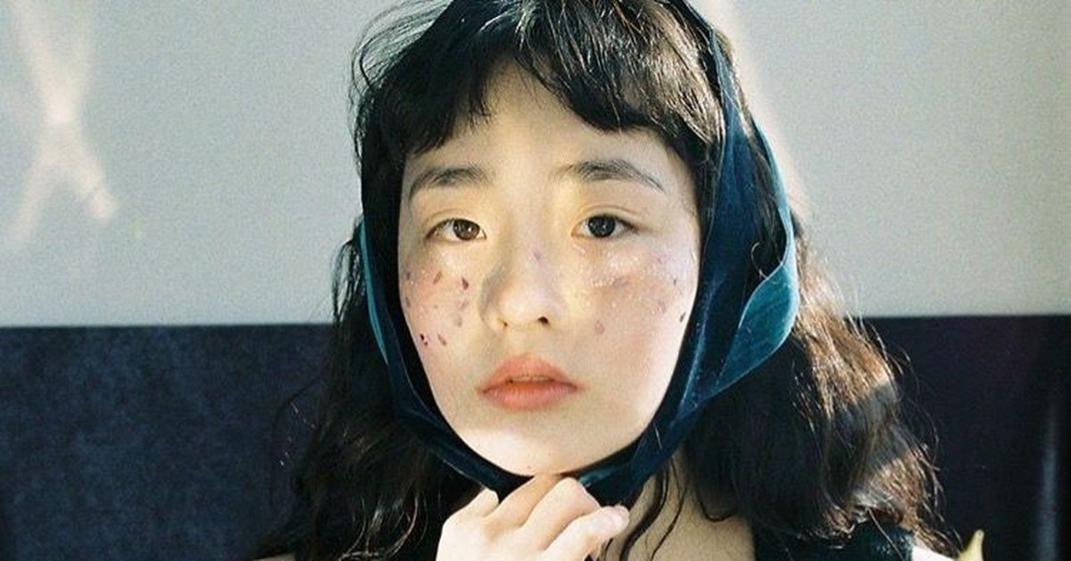 7 dấu hiệu trên mặt cảnh báo máu "ngập đường" theo lời khuyên bác sĩ