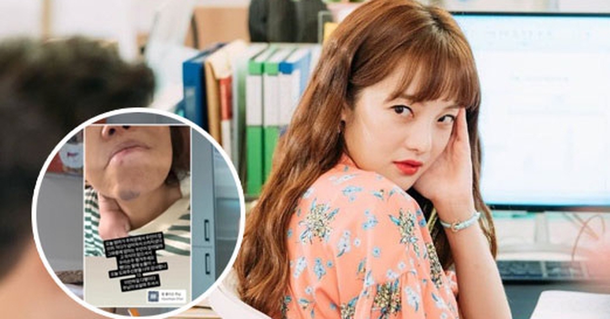 Mỹ nhân Thư Ký Kim bật khóc nấc vì mẹ ruột gặp tai nạn đến chấn động não trong lúc trông cháu