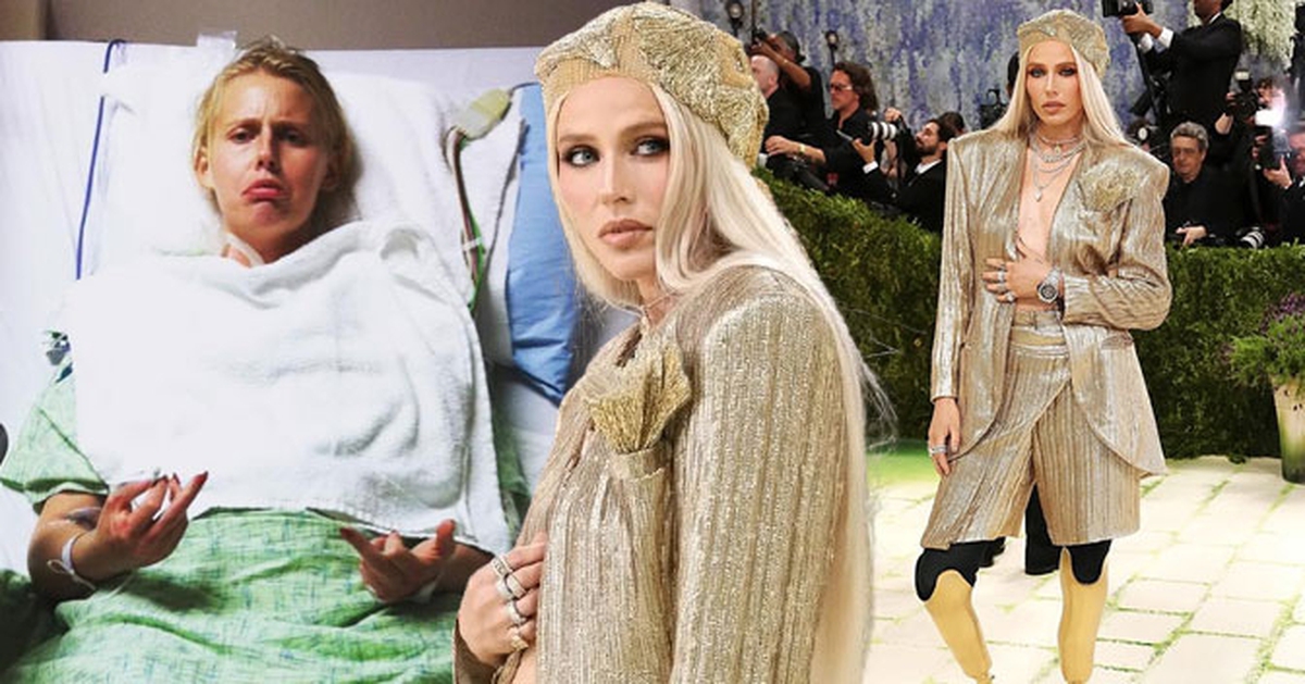 Nữ người mẫu bị cắt cụt chân, 14 năm sau mang chân giả đến đại náo Met Gala