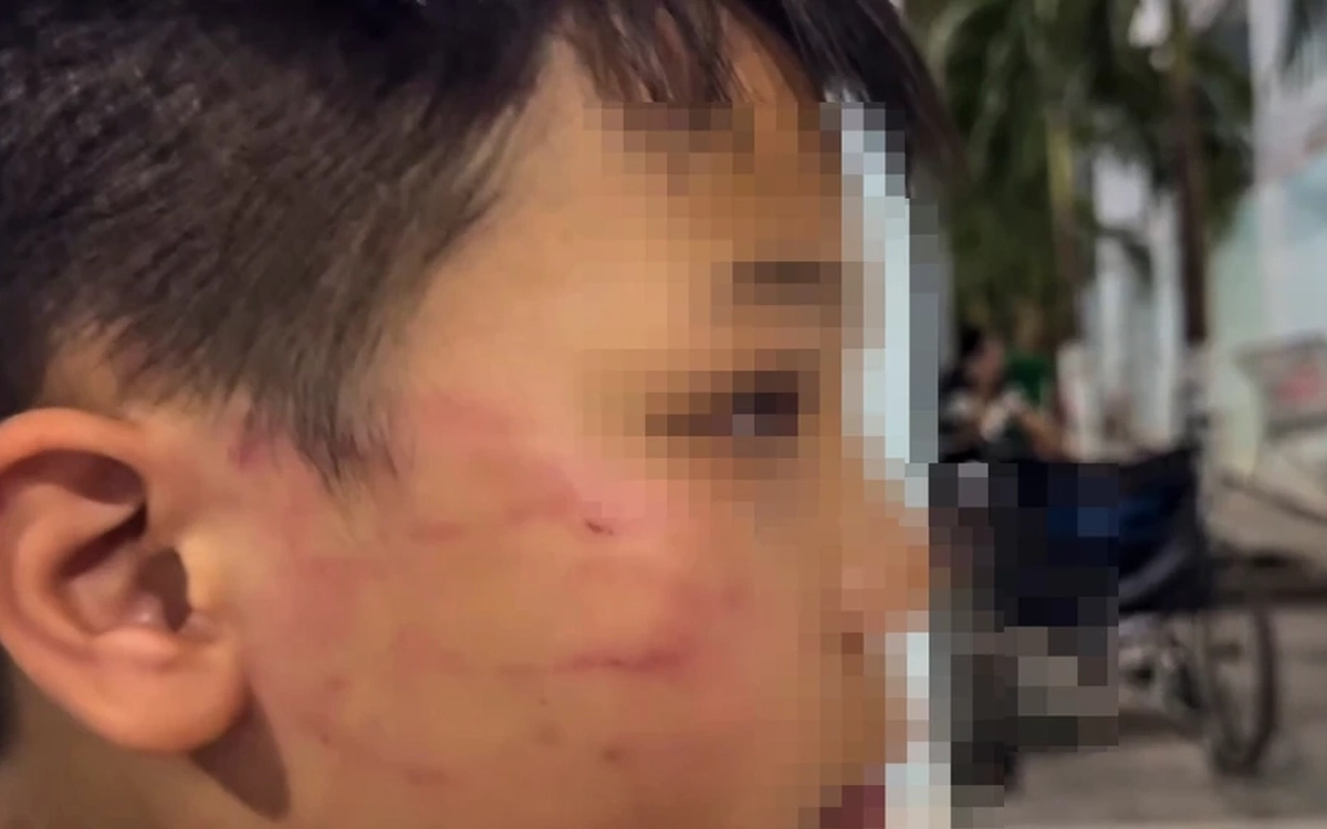 Tin mới vụ giáo viên người nước ngoài tát vào mặt học sinh