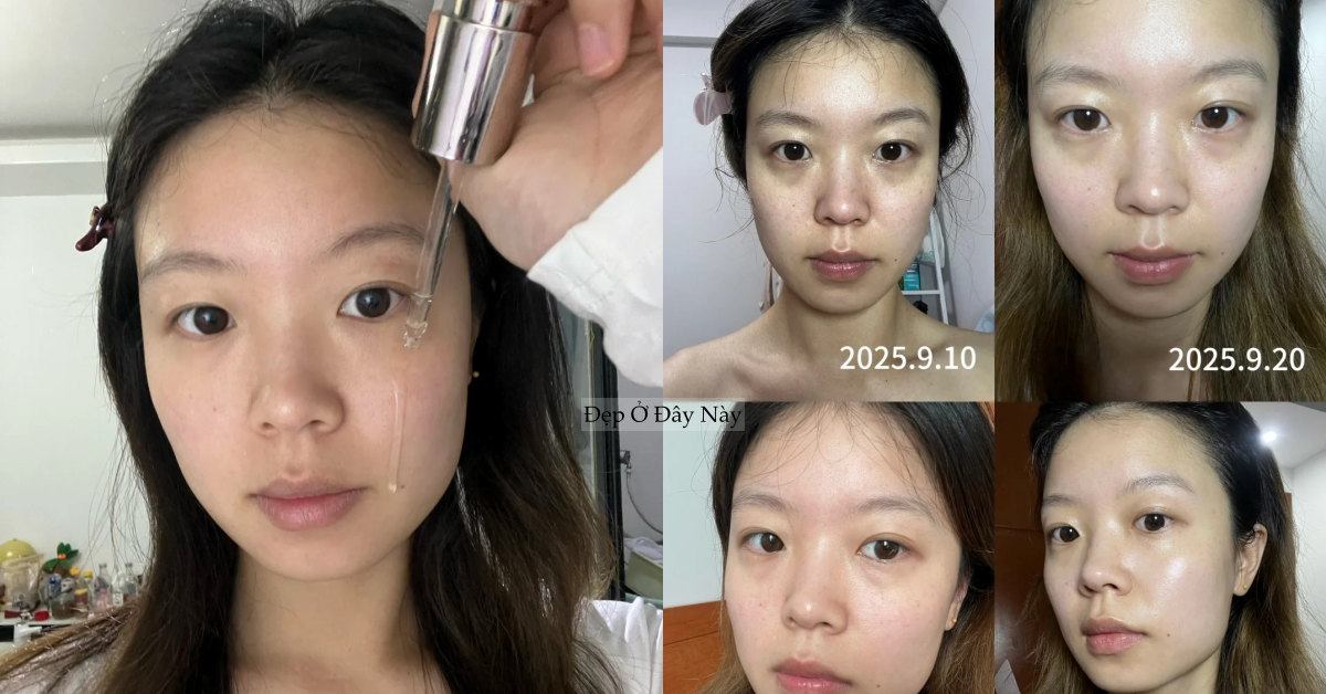 Review 1 tháng dùng serum vitamin C: Làn da có thêm "điểm cộng" nhưng cũng cần lưu ý