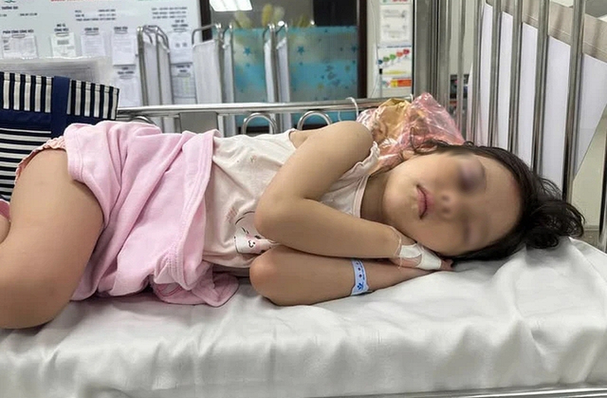 Mẹ bé gái bị đẩy ngã từ cầu trượt cao 1,5m chia sẻ tình trạng hiện tại của con: "Con tha lỗi cho bạn rồi ạ"