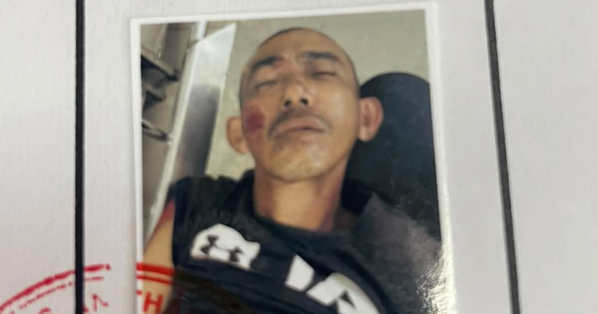 Phát hiện người đàn ông chấn thương ngồi thẫn thờ bên lề đường: Công an phát thông báo khẩn tìm người thân