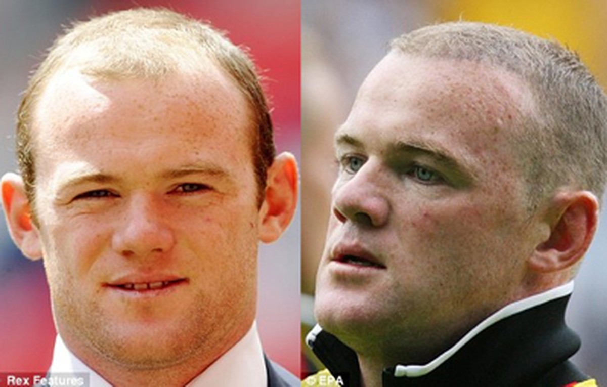 Rooney đã thực sự thoát khỏi “cơn ác mộng” hói đầu