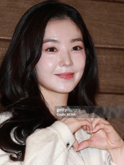 Khó tin nhất lúc này là làn da của Irene