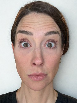 Tiêm botox vào một nửa khuôn mặt để xem ảnh hưởng thế nào đến vẻ bề ngoài: Nữ y tá "gây sốt" khi hé lộ kết quả!