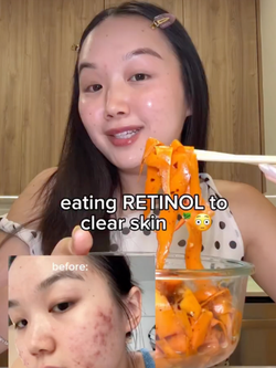 Bát salad 5’ tạo retinol dồi dào, mặt giảm hẳn mụn mà da vẫn lành