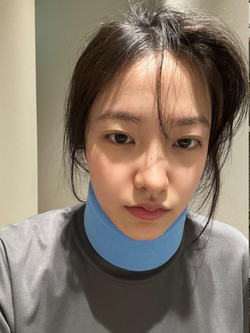 Nữ idol gãy cổ vì tập pilates