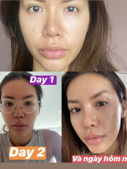 Minh Tú tuổi 34 phục hồi da thành công, mặt căng bóng rạng rỡ nhờ loại nước có nguyên liệu bán đầy ngoài chợ