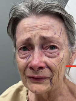 Bác sĩ thẩm mỹ được đặt lịch ồ ạt tới tận... 50 năm sau nhờ màn cải lão hoàn đồng thành công cho khách hàng