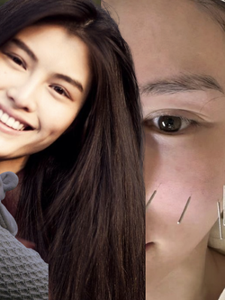 Vợ tổng tài hot nhất Trung Quốc ghim hàng chục cây kim lên mặt để ngăn xệ sau sinh