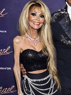 Tình trạng báo động của chị gái Michael Jackson