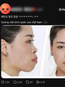 Người đẹp lột xác thành công nhờ "dao kéo" vướng lùm xùm liên quan đến miệt thị ngoại hình người Việt