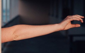 Nghi&ecirc;n cứu mới: Con người tiếp tục ph&aacute;t triển th&ecirc;m một động mạch giữa trong c&aacute;nh tay