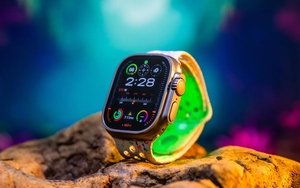 Tính năng hỗ trợ sức khỏe mà người dùng nên tận dụng trên Apple Watch và iPhone