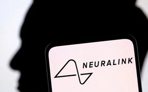 Người đầu tiên cấy chip Neuralink vào não có thể chơi game trên laptop bằng ý nghĩ