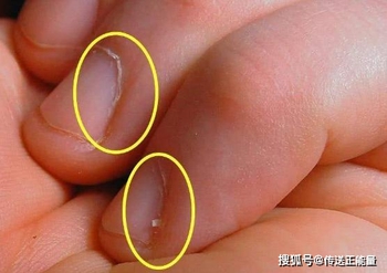 3 biểu hiện trên móng tay đang cảnh báo bạn bị thiếu máu, không phát hiện ra sớm để bồi bổ thì cơ thể sớm muộn gì cũng sinh bệnh - Ảnh 1.