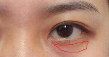 4 biểu hiện trên khuôn mặt cho thấy nữ giới đang mắc bệnh phụ khoa, chỉ cần phát hiện ra 1 cái cũng cần đi khám ngay - Ảnh 1.