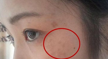 4 biểu hiện trên khuôn mặt cho thấy nữ giới đang mắc bệnh phụ khoa, chỉ cần phát hiện ra 1 cái cũng cần đi khám ngay - Ảnh 2.