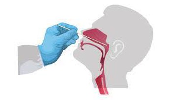 Dương tính giả và cách thực hiện test nhanh tại nhà đúng cách - Ai cũng cần biết! - Ảnh 2. Dương tính giả và cách thực hiện test nhanh tại nhà đúng cách - Ai cũng cần biết! - Ảnh 2.