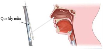 Dương tính giả và cách thực hiện test nhanh tại nhà đúng cách - Ai cũng cần biết! - Ảnh 3. Dương tính giả và cách thực hiện test nhanh tại nhà đúng cách - Ai cũng cần biết! - Ảnh 3.