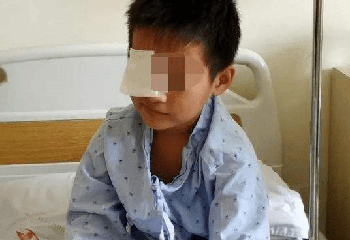 Cậu bé 10 tuổi suýt bị mù vì thói quen dùng thuốc nhỏ mắt mà nhiều bố mẹ vẫn làm - Ảnh 1.