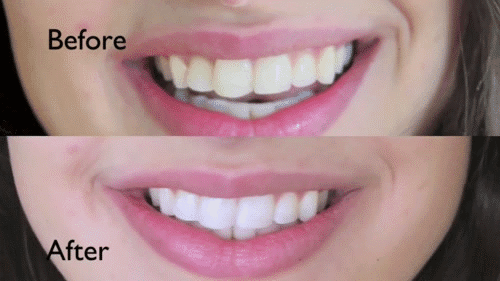 Tẩy răng sáng bóng trong 5 phút với các nguyên liệu 100% tự nhiên - Ảnh 9.