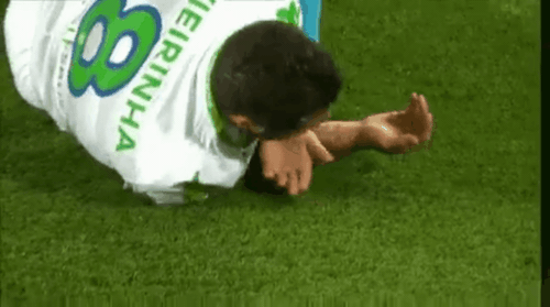 Cầu thủ Wolfsburg g&atilde;y răng sau pha va chạm với Toni Kroos - Ảnh 3.