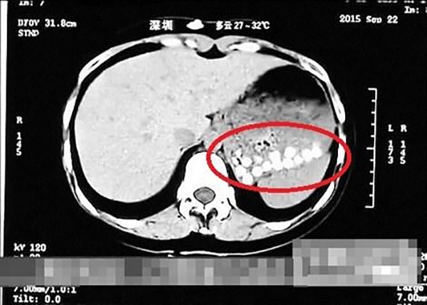 151025tsua03-db158