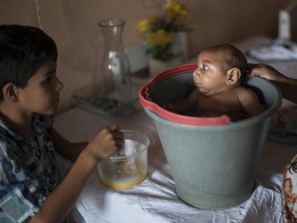 Tốc độ l&acirc;y lan của virus Zika g&acirc;y teo n&atilde;o đang đ&aacute;ng sợ đến mức n&agrave;o? - Ảnh 3.