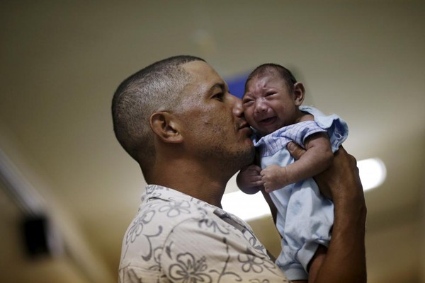 Chùm ảnh: Gương mặt đáng thương của những đứa trẻ bị nhiễm virus gây teo não Zika - Ảnh 1.