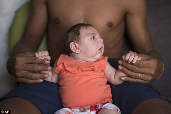 H&agrave;ng ng&agrave;n trẻ mắc tật đầu nhỏ ở Brazil c&oacute; thể l&agrave; nạn nh&acirc;n của virus muỗi Zika - Ảnh 2.