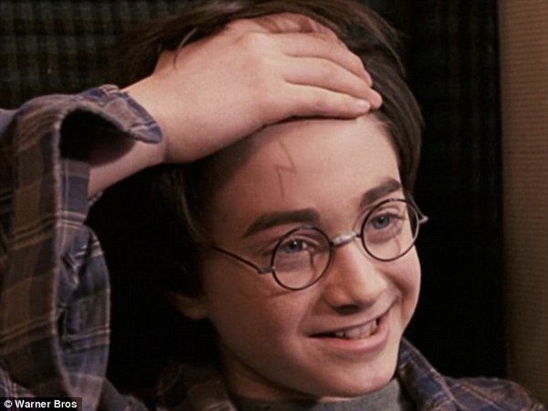 Gặp gỡ Harry Potter phiên bản đời thực mới chào đời - Ảnh 2.