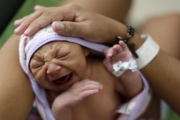 Chùm ảnh: Gương mặt đáng thương của những đứa trẻ bị nhiễm virus gây teo não Zika - Ảnh 2.
